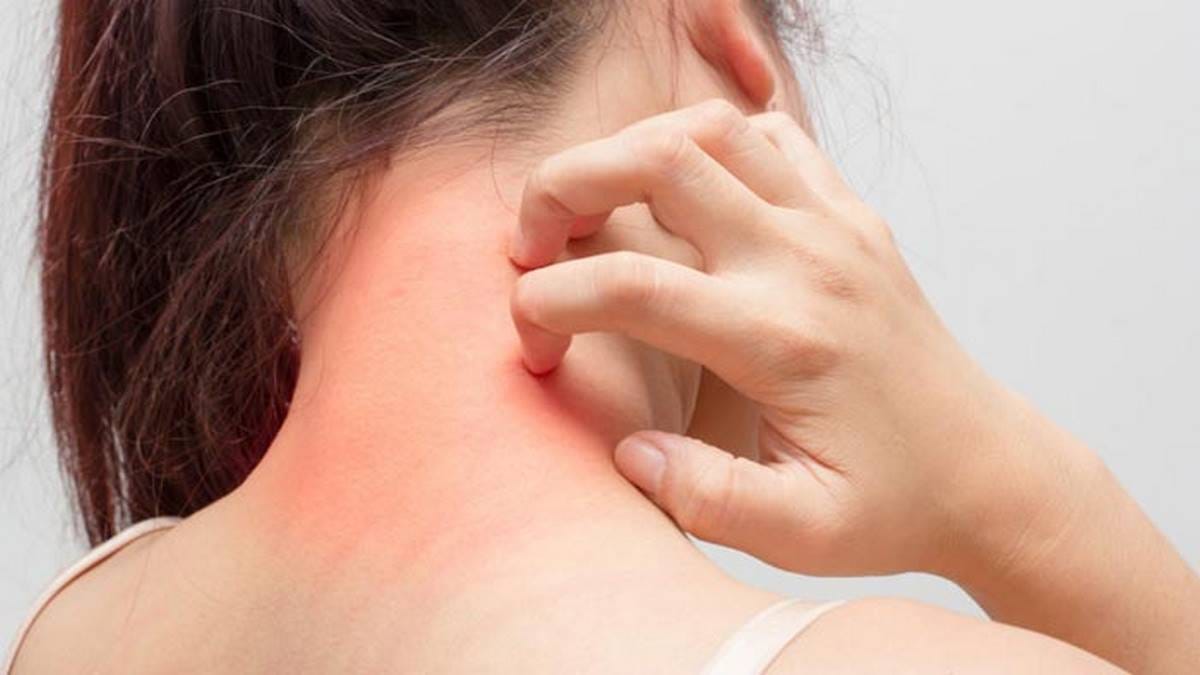 എസി യൂണിറ്റ് കൃത്യമായി വൃത്തിയാക്കിയില്ലെങ്കിൽ, അലർജി ഉണ്ടാക്കുന്ന പൊടി, പൂമ്പൊടി, പൂപ്പൽ, വളർത്തു മൃഗങ്ങളുടെ രോമം മുതലായവ വ്യാപിക്കാൻ ഇടയാക്കും. ഇത് അലർജി ഉണ്ടാക്കും. 