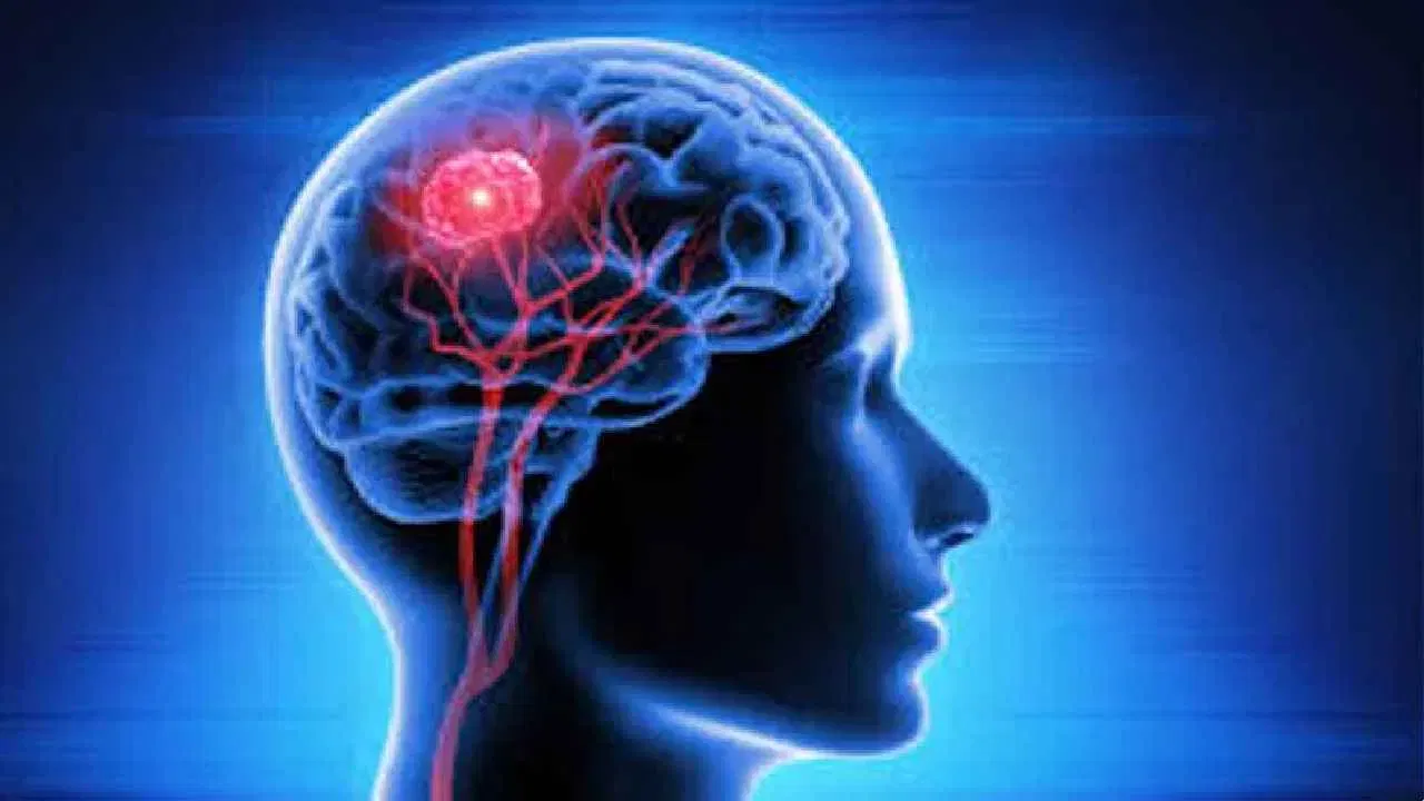 Brain mapping