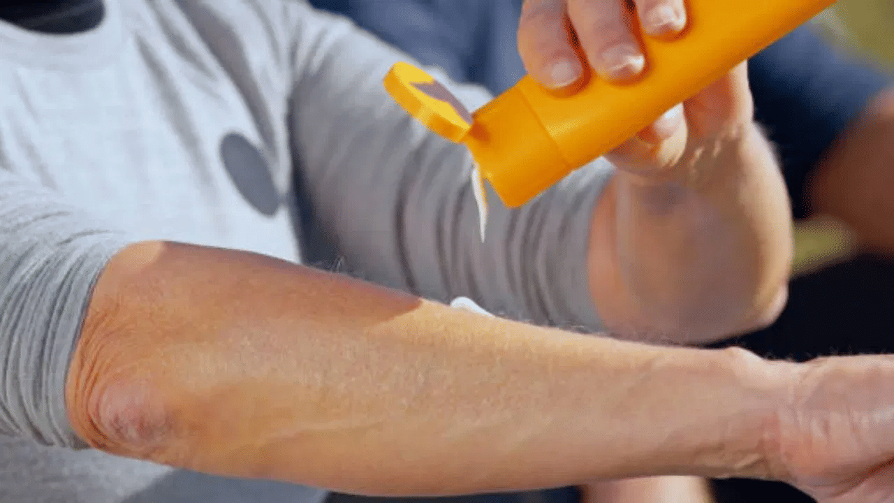 കോമ്പിനേഷന് സ്കിന്: മുഖത്തിന്റെ ചിലഭാഗങ്ങള് വരണ്ടതും ചിലഭാഗങ്ങള് എണ്ണമയമായുള്ളതുമാണ് കോമ്പിനേഷന് സ്കിന്. ഇത്തരക്കാര് ഭാരം കുറഞ്ഞ ജെല് പോലുള്ള സണ്സ്ക്രീന് വേണം ഉപയോഗിക്കാന്. എണ്ണമയമുള്ള ഭാഗത്തിന് ലൈറ്റ് വൈറ്റായതും വരണ്ട ഭാഗത്തിന് മിനുസമാര്ന്നതുമായ സണ്സ്ക്രീനാണ് ഉപയോഗിക്കേണ്ടത്.