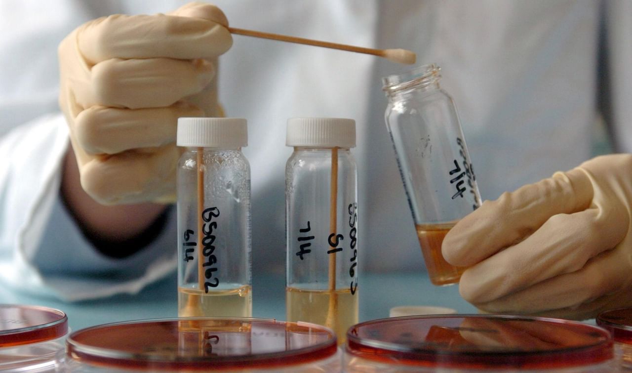 Avian influenza: പക്ഷിപ്പനിക്കെതിരേ വാക്സിൻ വികസിപ്പിക്കാനൊരുങ്ങി ഗവേഷകർ Avian influenza: പക്ഷിപ്പനിക്കെതിരേ വാക്സിൻ വികസിപ്പിക്കാനൊരുങ്ങി ഗവേഷകർ