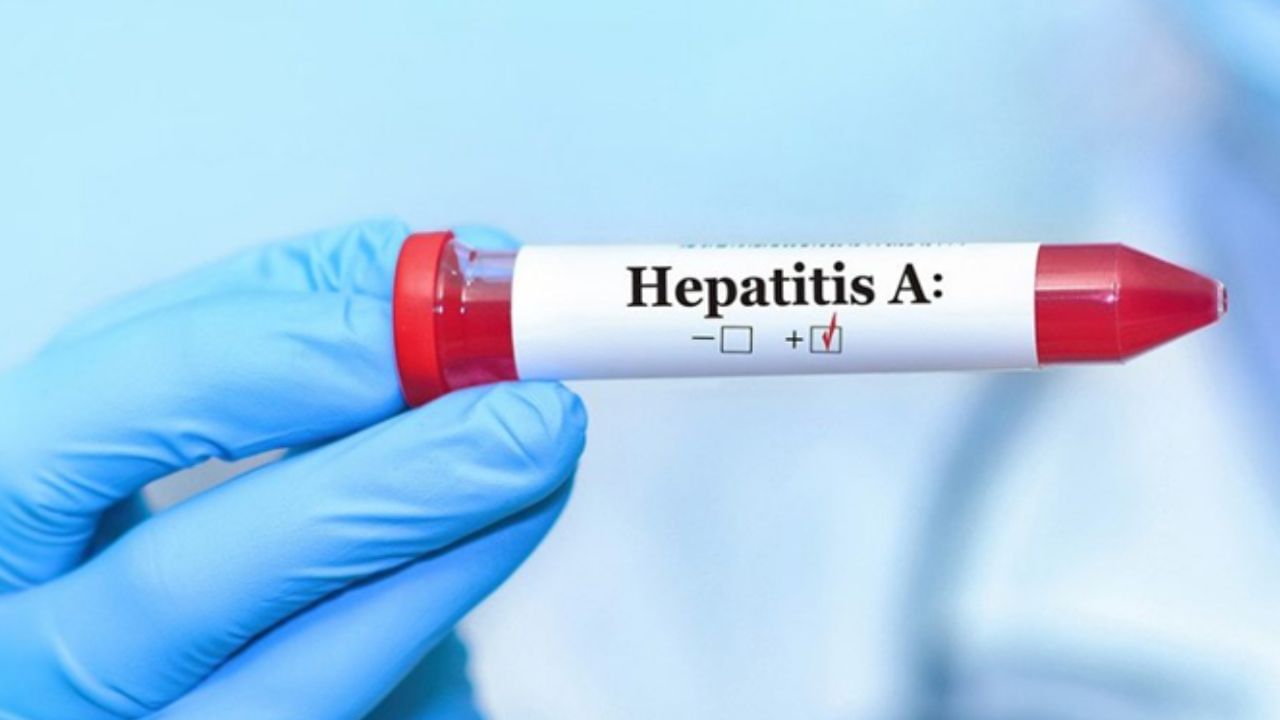 Kerala Hepatitis Outbreak : വേങ്ങൂരിൽ 208 പേർക്ക് മഞ്ഞപ്പിത്തം,  രണ്ട് പേരുടെ നില ഗുരുതരം