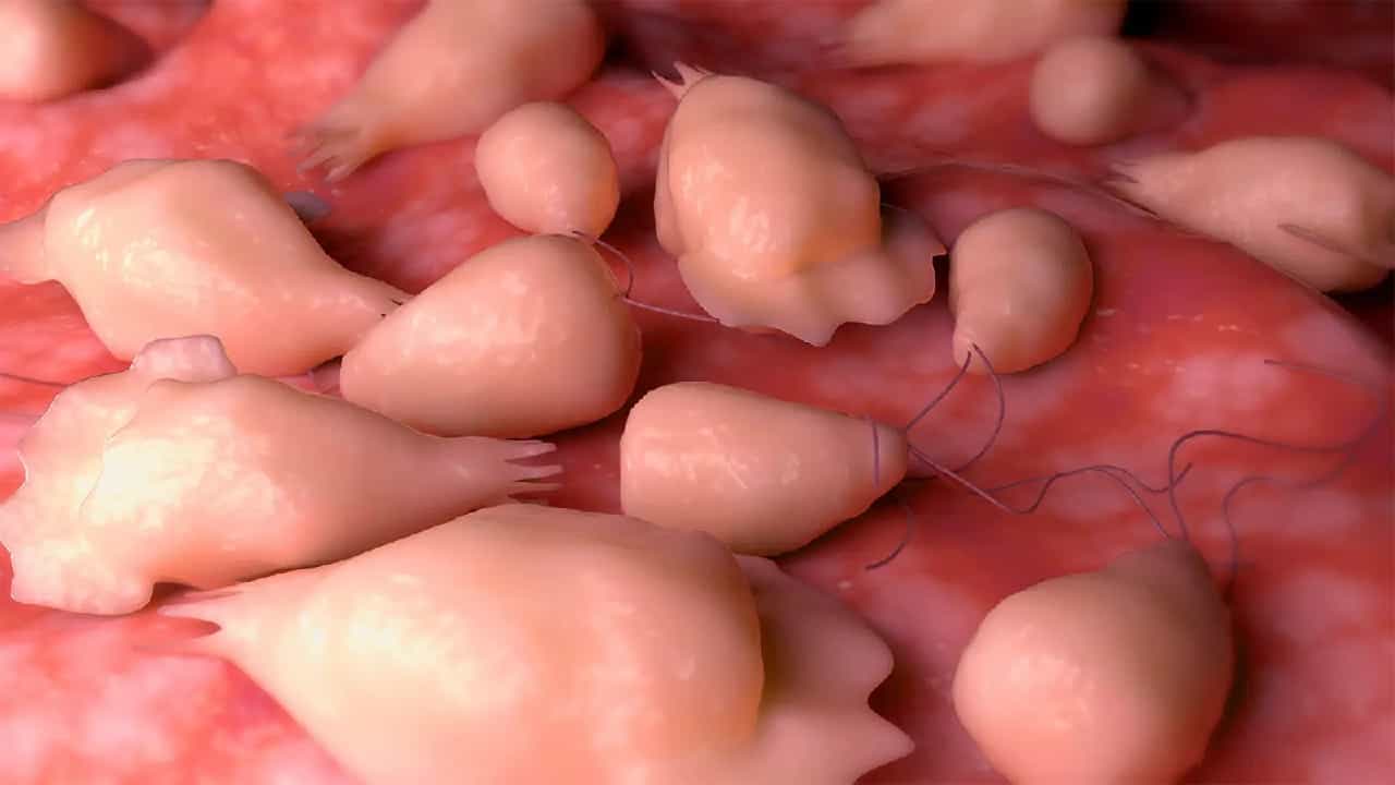 Amoebic Meningoencephalitis: അമീബിക് മസ്തിഷ്‌ക ജ്വരം; ചികിത്സയില്‍ കഴിഞ്ഞിരുന്ന അഞ്ചുവയസുകാരി മരിച്ചു