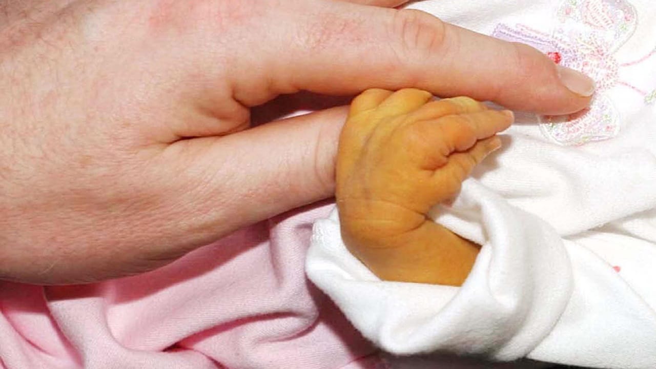 മഞ്ഞപ്പിത്തത്തിന്റെ ലക്ഷണങ്ങള് എന്നുപറയുന്നത് ഇവയാണ്- തുടക്കത്തില് പറഞ്ഞതുപോലെ മഞ്ഞനിറമാണ് ആദ്യ ലക്ഷണം. കണ്ണികളിലായിരിക്കും ആദ്യം മഞ്ഞനിറം കാണുക. രോഗം ഗുരുതരമാകുന്നതിന് അനുസരിച്ചാണ് ശരീരത്തിന്റെ മറ്റ് ഭാഗങ്ങളിലേക്ക് മഞ്ഞനിറം വ്യാപിക്കുക.