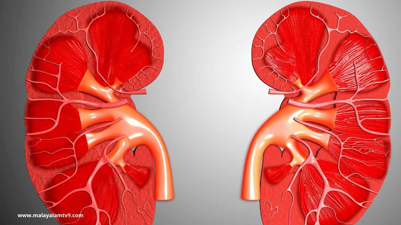 Kerala Organ Trade: ഇറാൻ ആശുപത്രിയിൽ നിന്ന് വൃക്ക മാറ്റിവെച്ചവർ ഇന്ത്യക്കാർ, വാങ്ങിയത് 12 കോടി