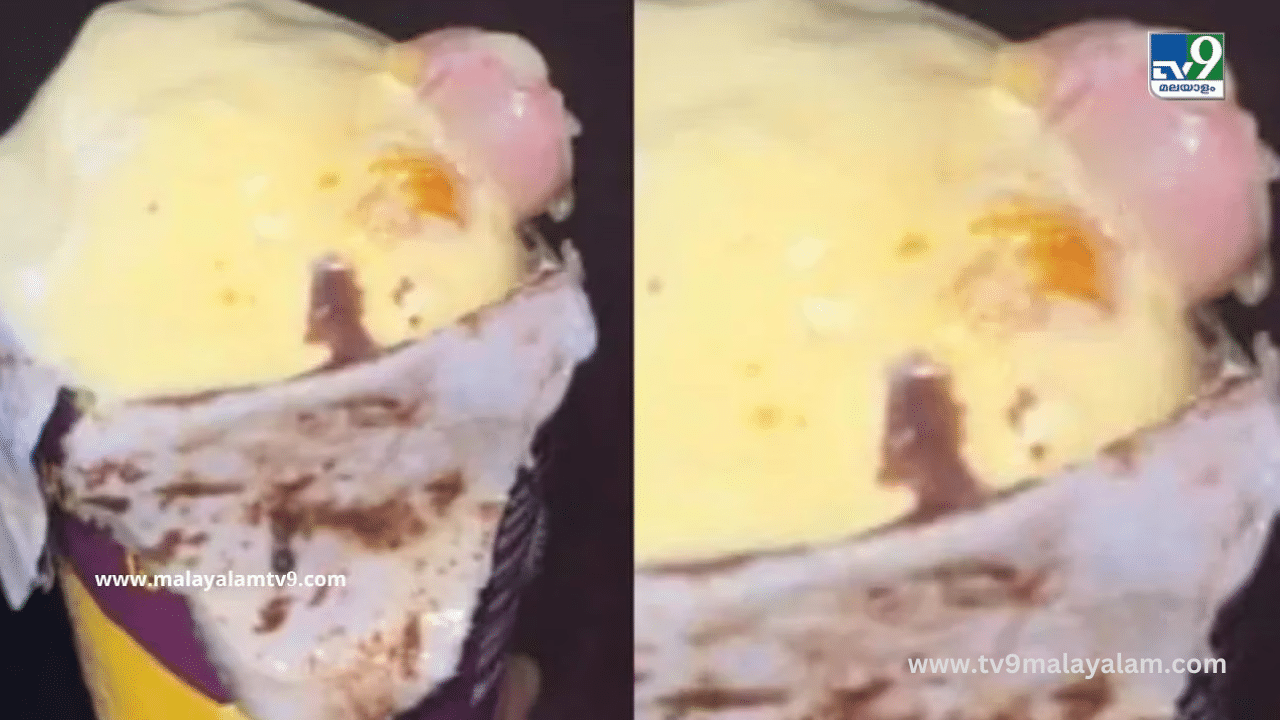 Human Finger in Ice-cream: ഐസ്ക്രീമിൽ മനുഷ്യ വിരൽ കണ്ടെത്തിയ സംഭവം: കമ്പനിയുടെ ലൈസൻസ് സസ്പെൻഡ് ചെയ്തു