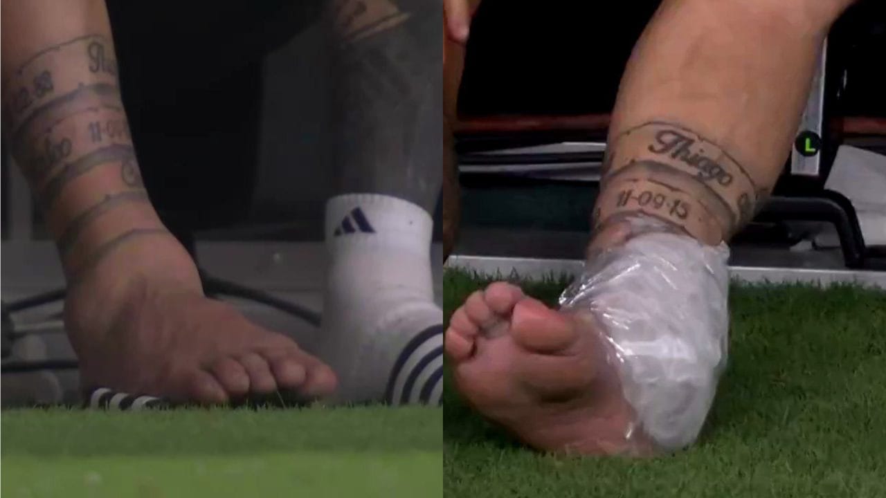 പന്തിനുപിന്നാലെ ഓടുന്നതിനിടെ കാല് തെന്നിവീണ മെസി മെഡിക്കലിനെ വിളിച്ചെങ്കിലും തുടർന്ന് കളിക്കാനാവില്ലെന്ന് മെഡിക്കൽ ടീം അറിയിച്ചു. ഇതോടെ നിർബന്ധിതമായ കളം വിടേണ്ടിവന്നു താരത്തിന്. കണ്ണങ്കാലിൽ ഐസ് പാക്ക് വച്ച് ഡഗൗട്ടിലിരുന്ന് കരയുന്ന മെസിയുടെ ചിത്രം സമൂഹമാധ്യമങ്ങളിൽ പ്രചരിച്ചിരുന്നു. 