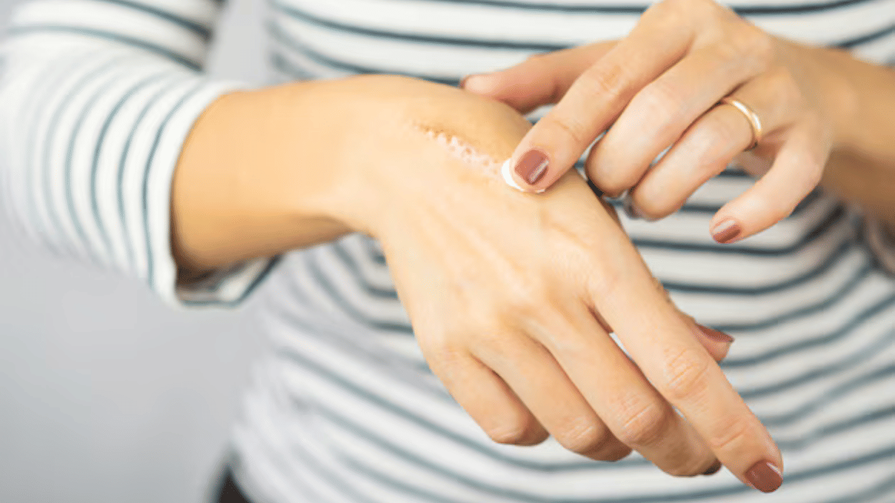 അടുക്കളയിലും മറ്റും ജോലി ചെയ്യുമ്പോൾ ചെറു പൊള്ളലുകൾ ഏൽക്കാനുള്ള സാദ്ധ്യതകൾ കൂടുതലാണ്. അങ്ങനെ ചെറു പൊള്ളലുകൾ ഏൽക്കുമ്പോൾ ചെയ്യാവുന്ന ചെറിയ നുറുങ്ങ് വിദ്യകൾ ഉണ്ട്. അതിൽ ചിലത് നോക്കാം.