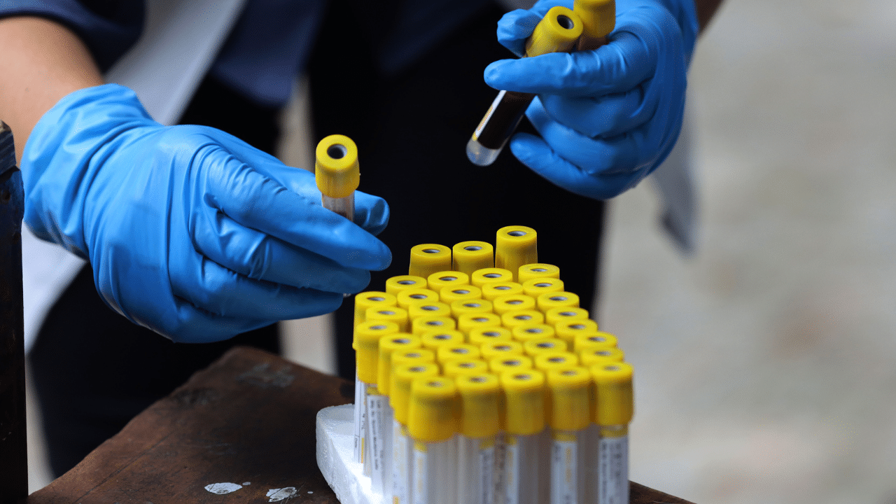 Covid -19 testing tool: മിന്നാമിനുങ്ങിലെ സയൻസുകൊണ്ട് ഒരു കോവിഡ് ടെസ്റ്റ്, ബയോലുമിനെസെൻസ് ഉപയോഗിച്ച് ടെസ്റ്റ് ചെയ്യുന്ന മെഷീനുമായി ശാസ്ത്രജ്ഞർ Covid -19 testing tool: മിന്നാമിനുങ്ങിലെ സയൻസുകൊണ്ട് ഒരു കോവിഡ് ടെസ്റ്റ്, ബയോലുമിനെസെൻസ് ഉപയോഗിച്ച് ടെസ്റ്റ് ചെയ്യുന്ന മെഷീനുമായി ശാസ്ത്രജ്ഞർ