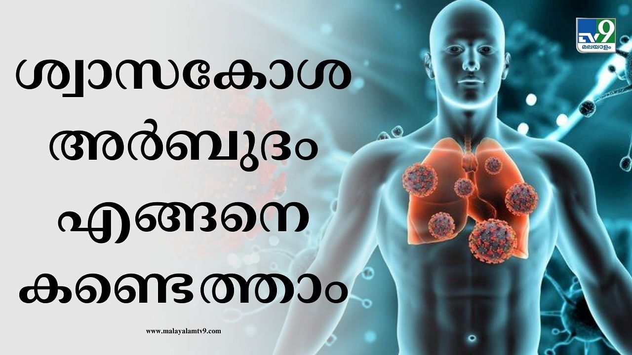 World Lung Cancer Day: ശ്വാസകോശ അര്‍ബുദം തള്ളികളയേണ്ട ഒന്നല്ല; ഈ ലക്ഷണങ്ങള്‍ അവഗണിക്കരുത്, കരുതലോടെ ഇരിക്കാം