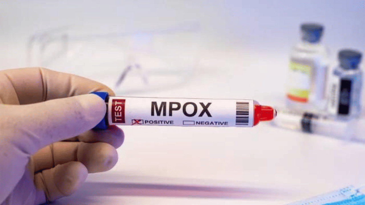 Mpox in Kerala: സംസ്ഥാനത്ത് ഒരാൾക്ക് കൂടി എംപോക്‌സ്‌ സ്ഥിരീകരിച്ചു