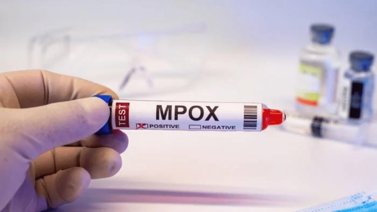 Mpox in Kerala: സംസ്ഥാനത്ത് ഒരാൾക്ക് കൂടി എംപോക്സ് സ്ഥിരീകരിച്ചു Mpox in Kerala: സംസ്ഥാനത്ത് ഒരാൾക്ക് കൂടി എംപോക്സ് സ്ഥിരീകരിച്ചു