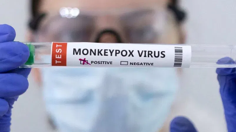 Monkeypox Case: അബുദാബിയിൽ നിന്ന് എത്തിയ വയനാട് സ്വദേശിക്ക് മങ്കി പോക്സ് സ്ഥിരീകരിച്ചു Monkeypox Case: അബുദാബിയിൽ നിന്ന് എത്തിയ വയനാട് സ്വദേശിക്ക് മങ്കി പോക്സ് സ്ഥിരീകരിച്ചു