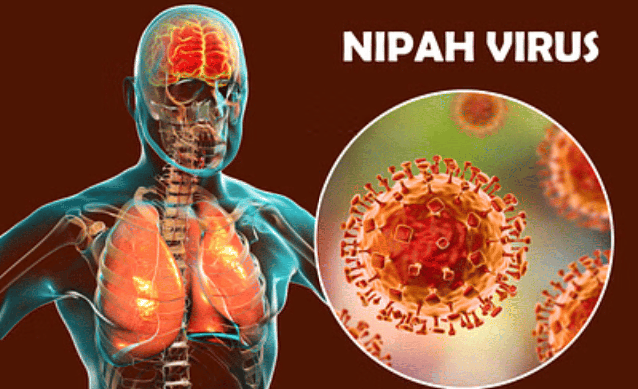 Nipah virus: ആശങ്ക ഒഴിയാതെ കേരളം; മലപ്പുറത്ത് മരിച്ച യുവാവിന് നിപ ബാധയെന്ന് സംശയം Nipah virus: ആശങ്ക ഒഴിയാതെ കേരളം; മലപ്പുറത്ത് മരിച്ച യുവാവിന് നിപ ബാധയെന്ന് സംശയം