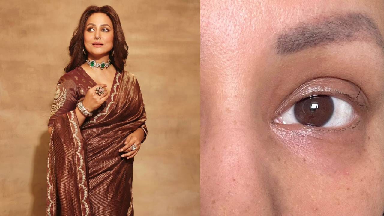 ഇപ്പോൾ എന്നോടൊപ്പം അർബുദത്തോട് പൊരുതി ഈ ധീരനായ യോദ്ധാവ് ഏകനായി നിൽക്കുകയാണ്. എന്റെ കീമോയുടെ അവസാന സൈക്കിൾ നടക്കുമ്പോൾ മറ്റെല്ലാ രോമങ്ങളും കൊഴിഞ്ഞുപോയെങ്കിലും ഈ ഒരൊറ്റ കൺപീലി എനിക്ക് പ്രചോദനം തരുന്നുണ്ട്. (Image credits: Instagram-hina khan)