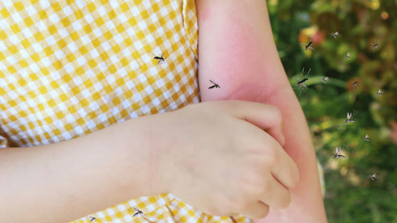 ഡെങ്കിപ്പനി, ചിക്കുൻഗുനിയ, മലമ്പനി, മലേറിയ എന്നിങ്ങനെ മിക്ക അസുഖങ്ങളും പരത്തുന്നത് കൊതുകുകളാണ്. കൊതുകുകളെ പൂർണമായി നശിപ്പിക്കുക എളുപ്പമല്ലെങ്കിലും നമ്മളിലെ ശുചിത്വ ശീലങ്ങൾ അവയുടെ വ്യാപനം കുറയ്ക്കാൻ സഹായിക്കും. ഇതിന് ആദ്യം വേണ്ടത് വീടിന് ചുറ്റും വെള്ളം കെട്ടി നിൽക്കാതെ നോക്കുക എന്നതാണ്. കൊതുക് കടി മൂലമുണ്ടാകുന്ന അസ്വസ്ഥത, ചൊറിച്ചിൽ, വീക്കം എന്നിവ ഒഴിവാക്കാനും ചില മാർ​ഗങ്ങളുണ്ട്. (Image Credits: Freepik)
