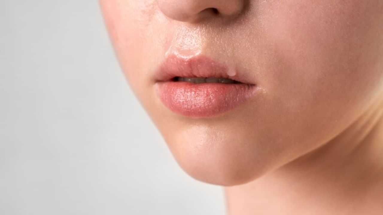 Chapped Lips: ചുണ്ടുകള്‍ വരണ്ട് പൊട്ടുന്നുണ്ടോ? ഇതൊന്ന് പരീക്ഷിച്ച് നോക്കൂ