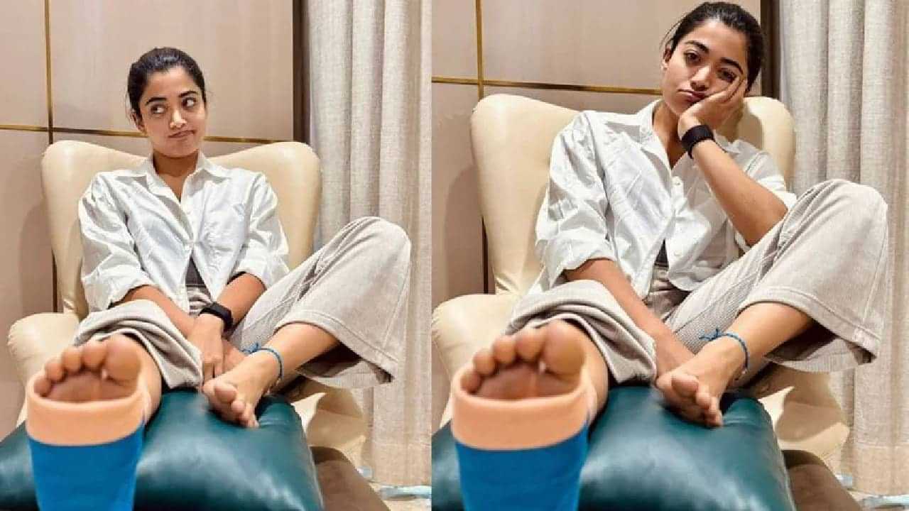 ‌Rashmika Mandanna: ദൈവത്തിന് മാത്രമേ അതറിയുള്ളൂ; വര്‍ക്കൗട്ടിനിടെ കാലിന് പരിക്കേറ്റ് രശ്മിക മന്ദാന