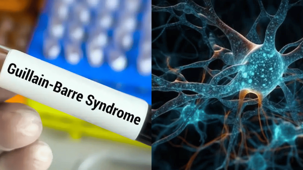 Guillain Barre Syndrome: ഗില്ലെയ്ൻ ബാരെ സിൻഡ്രോം: ആന്ധ്രയിൽ ഒരു മരണം കൂടി, പ്രതിരോധ പ്രവർത്തനം ഊർജ്ജിതം