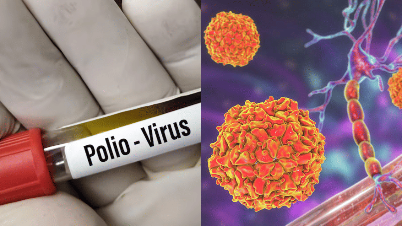 Pakistan Polio Virus: പാകിസ്താനിൽ വീണ്ടും പോളിയോ വൈറസ് ബാധ; 2025-ലെ മൂന്നാമത്തെ കേസ് Pakistan Polio Virus: പാകിസ്താനിൽ വീണ്ടും പോളിയോ വൈറസ് ബാധ; 2025-ലെ മൂന്നാമത്തെ കേസ്