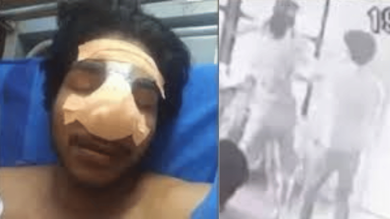 Ottapalam Students Fight: ഒറ്റപ്പാലത്ത് വിദ്യാർഥികൾ തമ്മിൽ സംഘർഷം; അടിപിടിയിൽ വിദ്യാർഥിയുടെ മൂക്കിന്റെ പാലം തകർന്നു