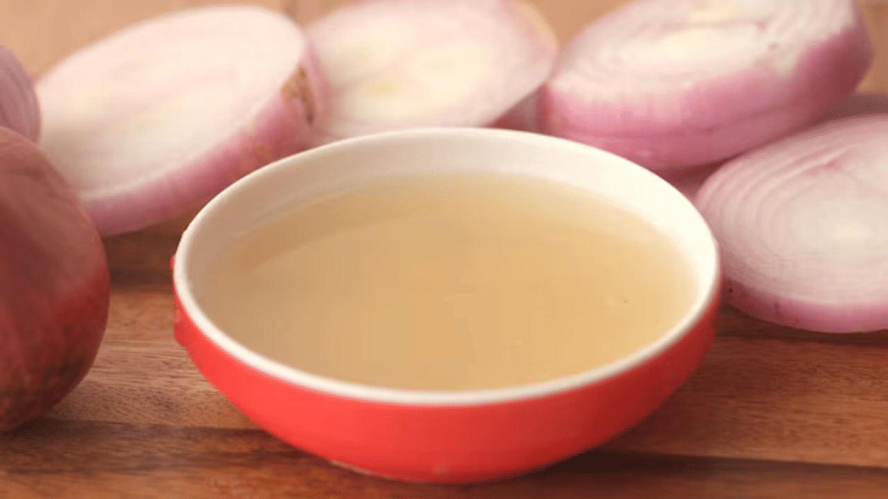 മുടി കൊഴിച്ചിലും കഷണ്ടിയും പലരും നേരിടുന്ന ഒരു പ്രശ്‌നമാണ്. വിവിധ ചികിത്സകളും പരിഹാരങ്ങളും നിലവിലുണ്ടെങ്കിലും,  ഒരു പ്രകൃതിദത്ത പരിഹാരമാണ് ഉള്ളി നീര്.  കഷണ്ടി പാടുകളോ മുടി കൊഴിച്ചിലോ കാരണം നിങ്ങൾ ബുദ്ധിമുട്ടുന്നുണ്ടെങ്കിൽ, ഇവ ഉപയോ​ഗിക്കാവുന്നതാണ്.  