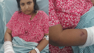 Woman Attacked In Kochi: കൊച്ചിയില്‍ മുഖംമൂടി സംഘത്തിന്റെ ആക്രമണം; വീട്ടമ്മയ്ക്ക് ഗുരുതര പരിക്ക്