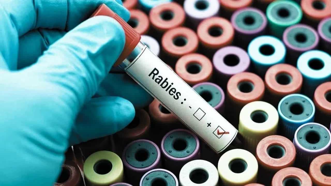 Rabies Child Death: പേവിഷബാധ കുത്തിവെപ്പെടുക്കാന് വൈകിയാല് എന്ത് സംഭവിക്കും? മരണം ഒഴിവാക്കാന് ചെയ്യേണ്ടത് Rabies Child Death: പേവിഷബാധ കുത്തിവെപ്പെടുക്കാന് വൈകിയാല് എന്ത് സംഭവിക്കും? മരണം ഒഴിവാക്കാന് ചെയ്യേണ്ടത്