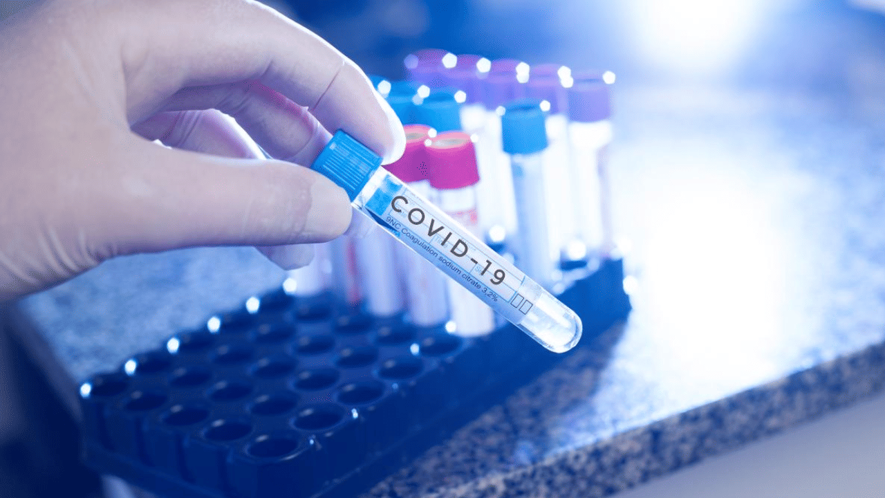 Kerala Covid Cases: സംസ്ഥാനത്ത് ആയിരം കടന്ന് കോവിഡ് കേസുകൾ; നാല് ദിവസത്തിനിടെ 717 പേർക്ക് രോ​ഗം