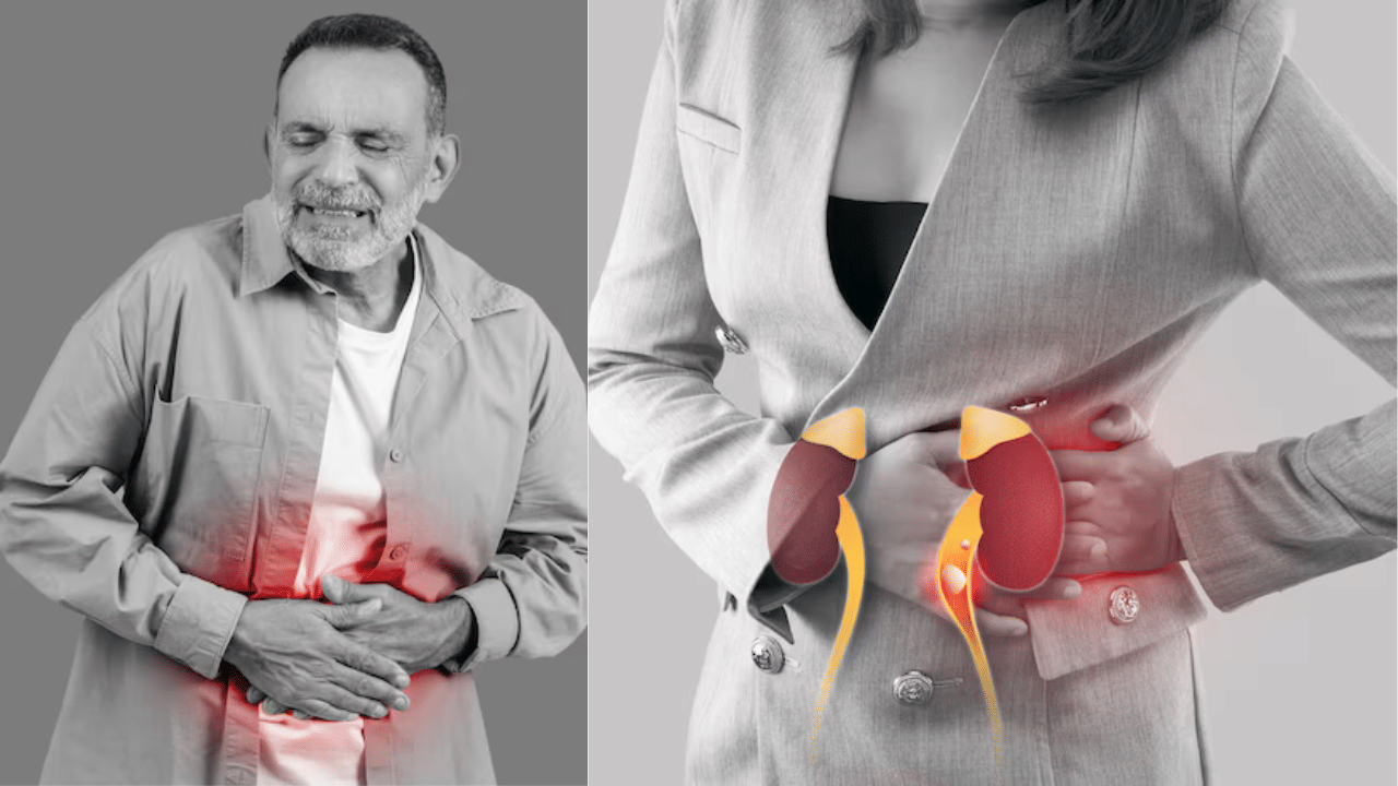 Kidney Stones: വൃക്കയിലെ കല്ലുകളുടെ ലക്ഷണം പുരുഷന്മാർക്കും സ്ത്രീകൾക്കും വ്യത്യസ്തമോ? Kidney Stones: വൃക്കയിലെ കല്ലുകളുടെ ലക്ഷണം പുരുഷന്മാർക്കും സ്ത്രീകൾക്കും വ്യത്യസ്തമോ?