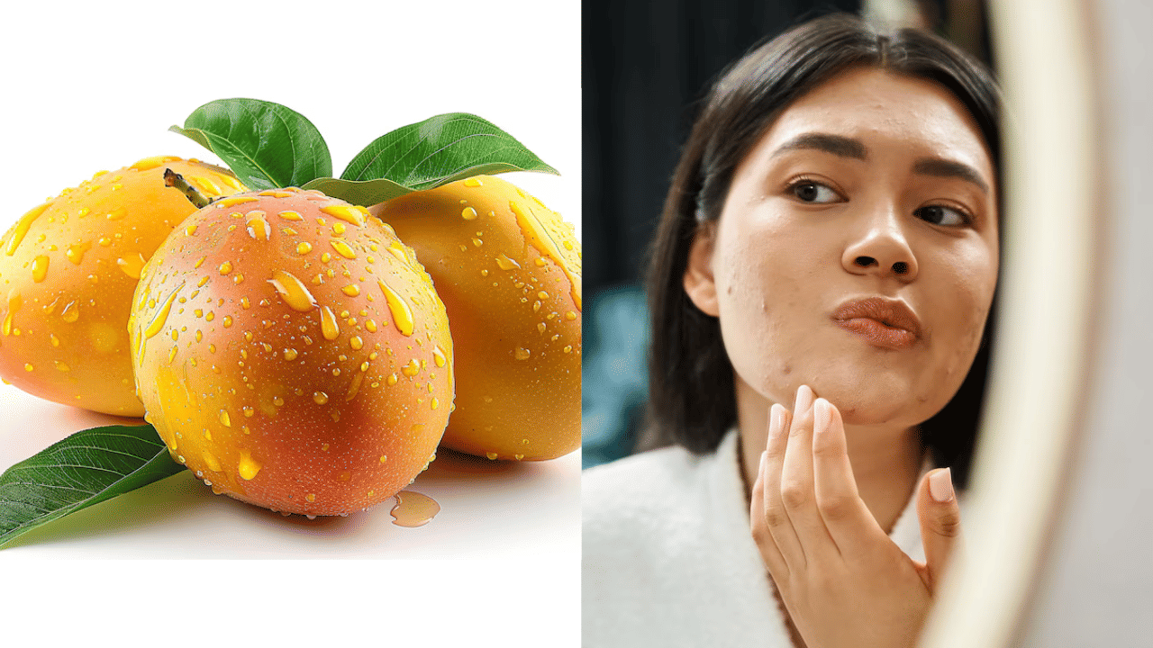 Pimple Free Skin: മാമ്പഴം കഴിച്ചാൽ മുഖക്കുരു വരുമോ? ചർമ്മ സംരക്ഷണത്തിന് അവ ഒഴിവാക്കേണ്ടതുണ്ടോ; കൂടുതലറിയാം Pimple Free Skin: മാമ്പഴം കഴിച്ചാൽ മുഖക്കുരു വരുമോ? ചർമ്മ സംരക്ഷണത്തിന് അവ ഒഴിവാക്കേണ്ടതുണ്ടോ; കൂടുതലറിയാം