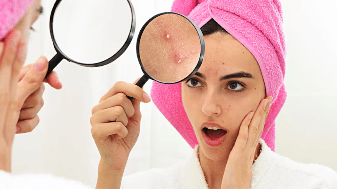 ചൂടുവെള്ളം: ഒരിക്കലും ചൂടുവെള്ളം ഉപയോഗിച്ച് മുഖം കഴുകരുത്. കാരണം ഇത് ചർമ്മത്തെ വരണ്ടതും മങ്ങിയതുമാക്കി മാറ്റുന്നു. ഈർപ്പത്തിന്റെ അളവ് കുറയ്ക്കുന്നു, മാത്രമല്ല പൊള്ളലിനും കാരണമാകും.  നിങ്ങളുടെ മുഖത്തെ സുഷിരങ്ങൾ തുറക്കുകയും അഴുക്ക് നീക്കം ചെയ്യുകയും ചെയ്യുന്ന ഇളം ചൂടുള്ള വെള്ളം തിരഞ്ഞെടുക്കുക.