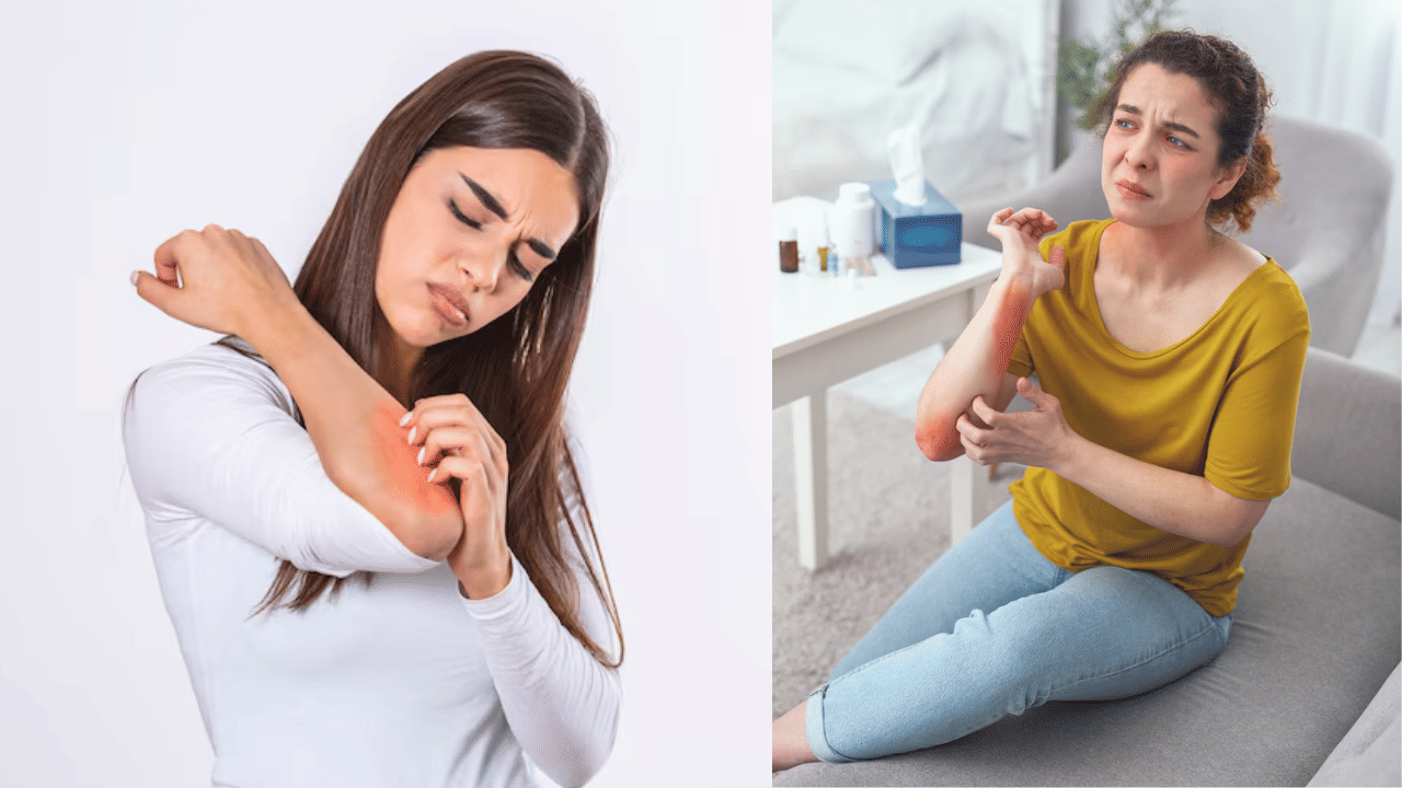 Uric Acid In Body: ക്ഷീണവും മൂത്രത്തിലെ നിറമാറ്റവും; ശരീരത്തിൽ യൂറിക് ആസിഡ് വർദ്ധിച്ചാൽ സംഭവിക്കുന്നത്