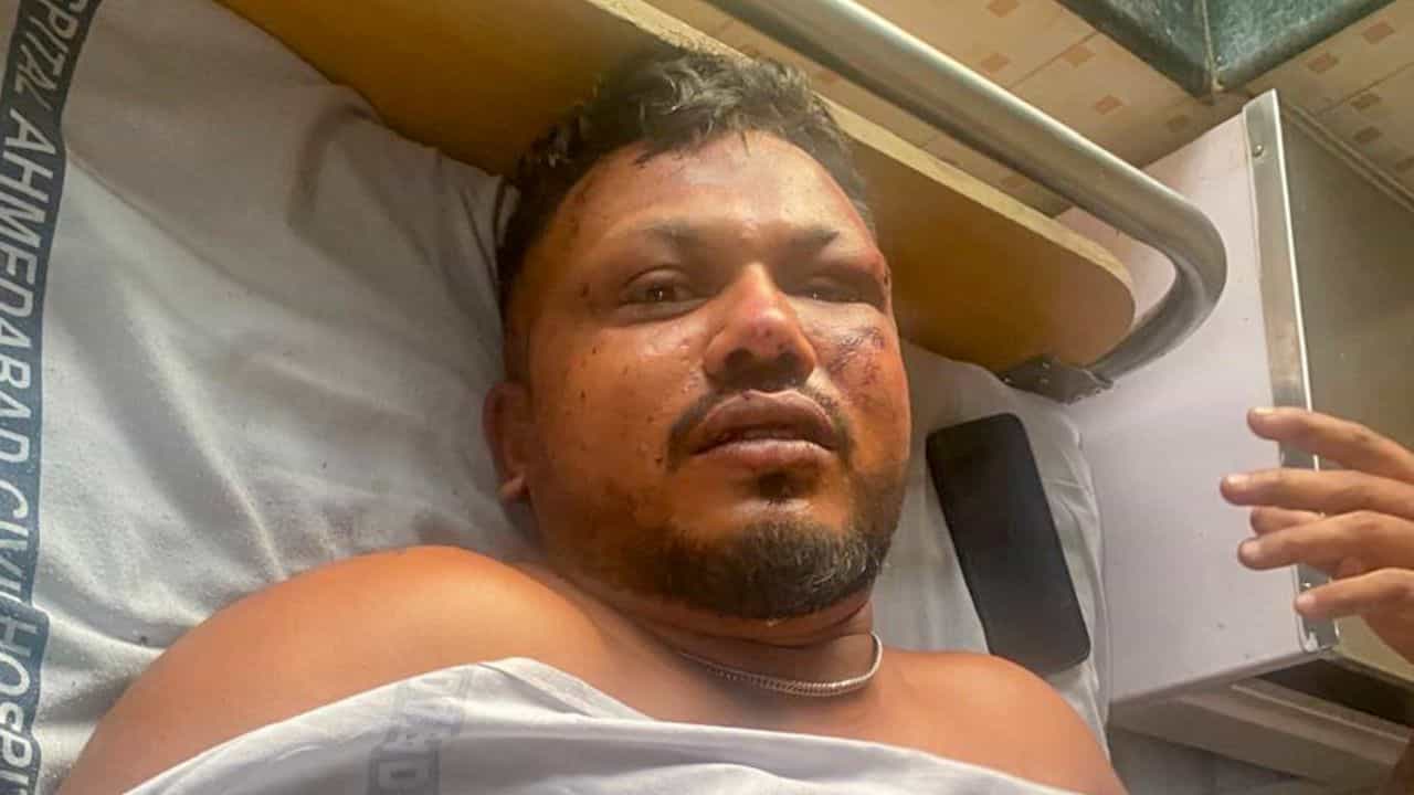 Ahmedabad Air India Crash: ഞാന്‍ എങ്ങനെ ജീവിച്ചിരിക്കുന്നുവെന്നറിയില്ല; അഹമ്മദാബാദ് വിമാനാപകടത്തില്‍ നിന്നും രക്ഷപ്പെട്ട യുവാവ്