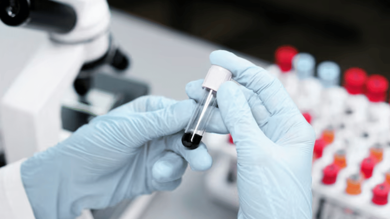 Cancer Detection: ബ്ലഡ് ടെസ്റ്റിലൂടെ കാൻസർ നേരത്തെ കണ്ടെത്താം; പുതിയ പഠനം Cancer Detection: ബ്ലഡ് ടെസ്റ്റിലൂടെ കാൻസർ നേരത്തെ കണ്ടെത്താം; പുതിയ പഠനം