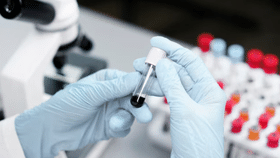 Cancer Detection: ബ്ലഡ് ടെസ്റ്റിലൂടെ കാൻസർ നേരത്തെ കണ്ടെത്താം; പുതിയ പഠനം Cancer Detection: ബ്ലഡ് ടെസ്റ്റിലൂടെ കാൻസർ നേരത്തെ കണ്ടെത്താം; പുതിയ പഠനം...
