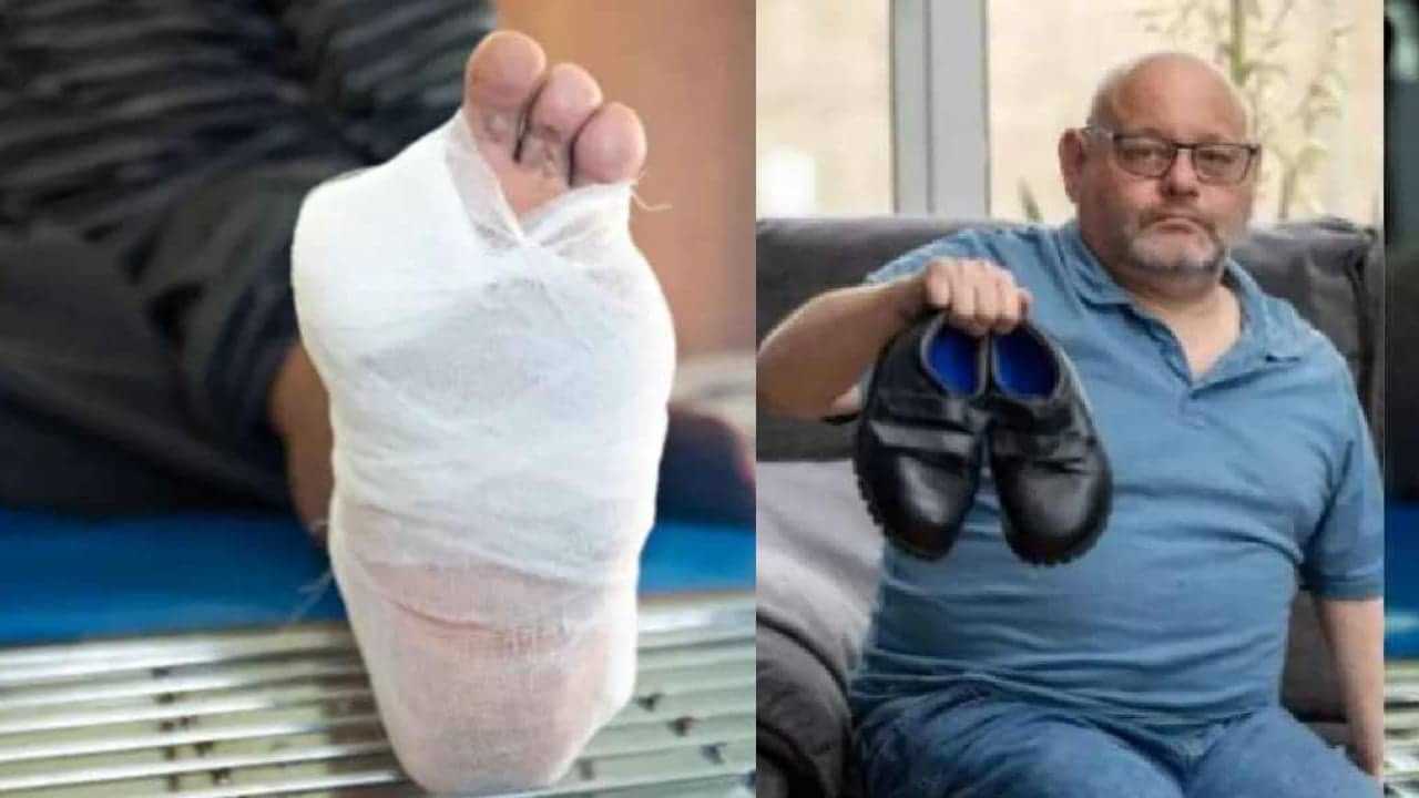 ചെറിയ ഷൂ ധരിച്ചു, പിന്നാലെ കാൽവിരലുകൾ മുറിച്ചുമാറ്റി; നിങ്ങൾക്കും ഇത് സംഭവിച്ചേക്കാം ചെറിയ ഷൂ ധരിച്ചു, പിന്നാലെ കാൽവിരലുകൾ മുറിച്ചുമാറ്റി; നിങ്ങൾക്കും ഇത് സംഭവിച്ചേക്കാം