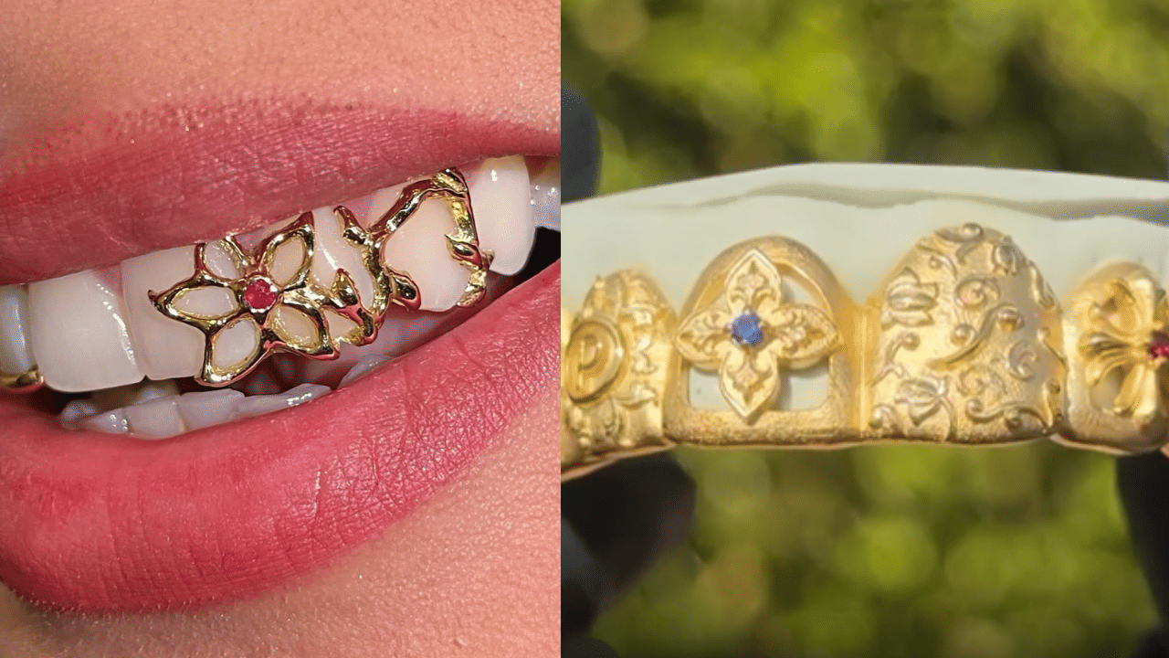 Bridal Grills: പല്ലിനും വേണ്ടേ ആഭരണ തിളക്കം; ഫാഷൻ ലോകത്ത് ട്രെൻഡായി ബ്രൈഡല് ഗ്രില് Bridal Grills: പല്ലിനും വേണ്ടേ ആഭരണ തിളക്കം; ഫാഷൻ ലോകത്ത് ട്രെൻഡായി ബ്രൈഡല് ഗ്രില്