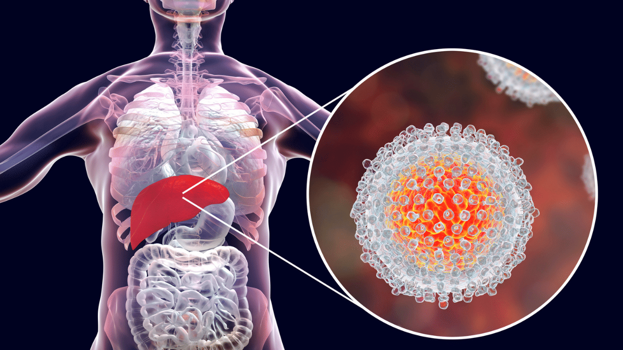 Hepatitis Deaths: മഞ്ഞപ്പിത്തം പടരുന്നു, മരണ നിരക്ക് കൂടുമ്പോൾ പ്രതിരോധ വാക്സിന്റെ ​ഗുണങ്ങൾ അറിയാം…
