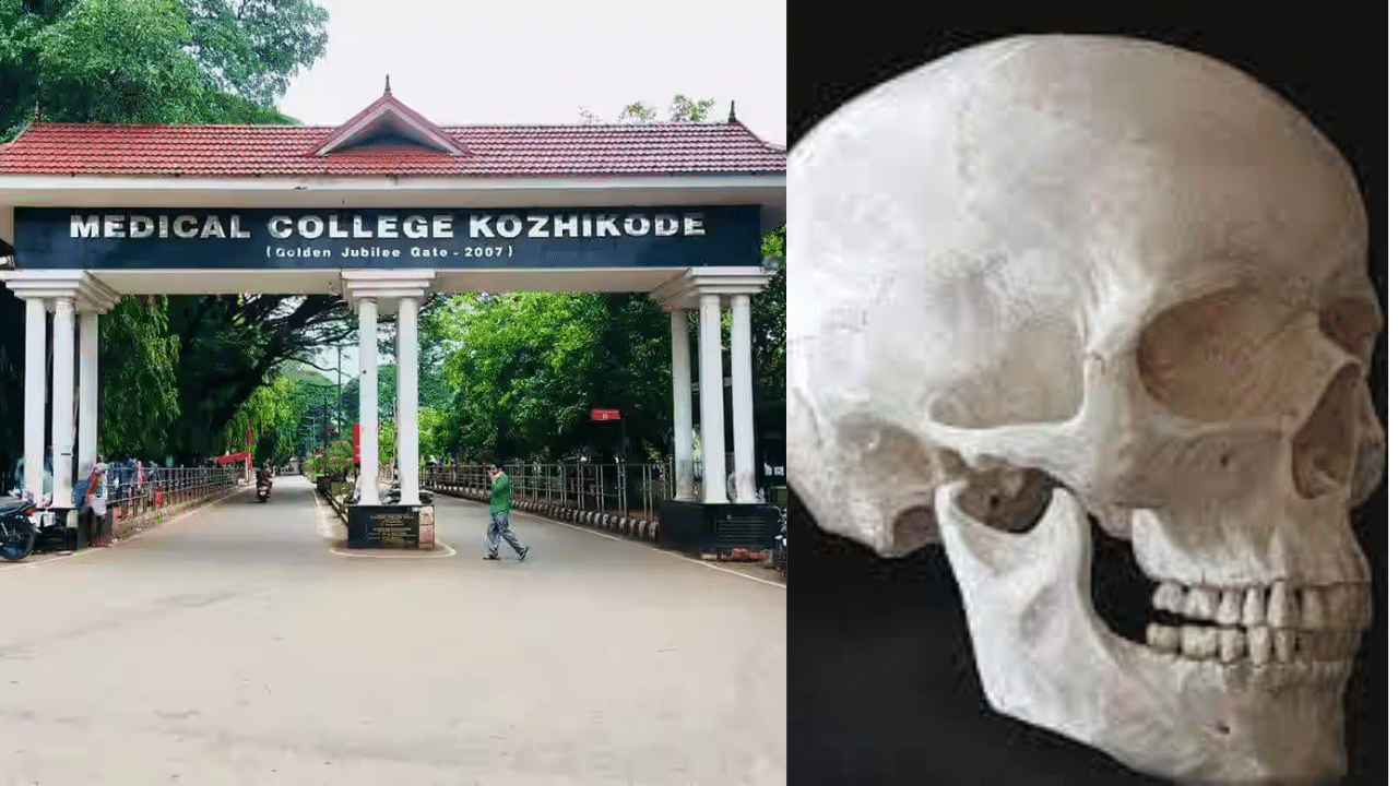 Kozhikode Medical College: കോഴിക്കോട് മെഡിക്കല് കോളേജ് കോംപൗണ്ടില് തലയോട്ടിയും അസ്ഥികളും കണ്ടെത്തി Kozhikode Medical College: കോഴിക്കോട് മെഡിക്കല് കോളേജ് കോംപൗണ്ടില് തലയോട്ടിയും അസ്ഥികളും കണ്ടെത്തി