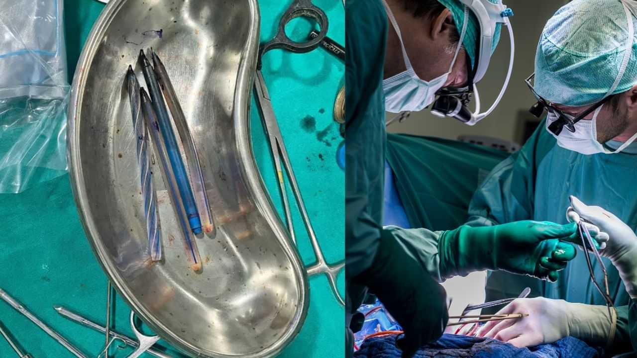 Viral News : കടുത്ത വയറുവേദനയും ഛർദിയും; പരിശോധിച്ചപ്പോൾ 28കാരിയുടെ വയറ്റിൽ നാല് പേനകൾ