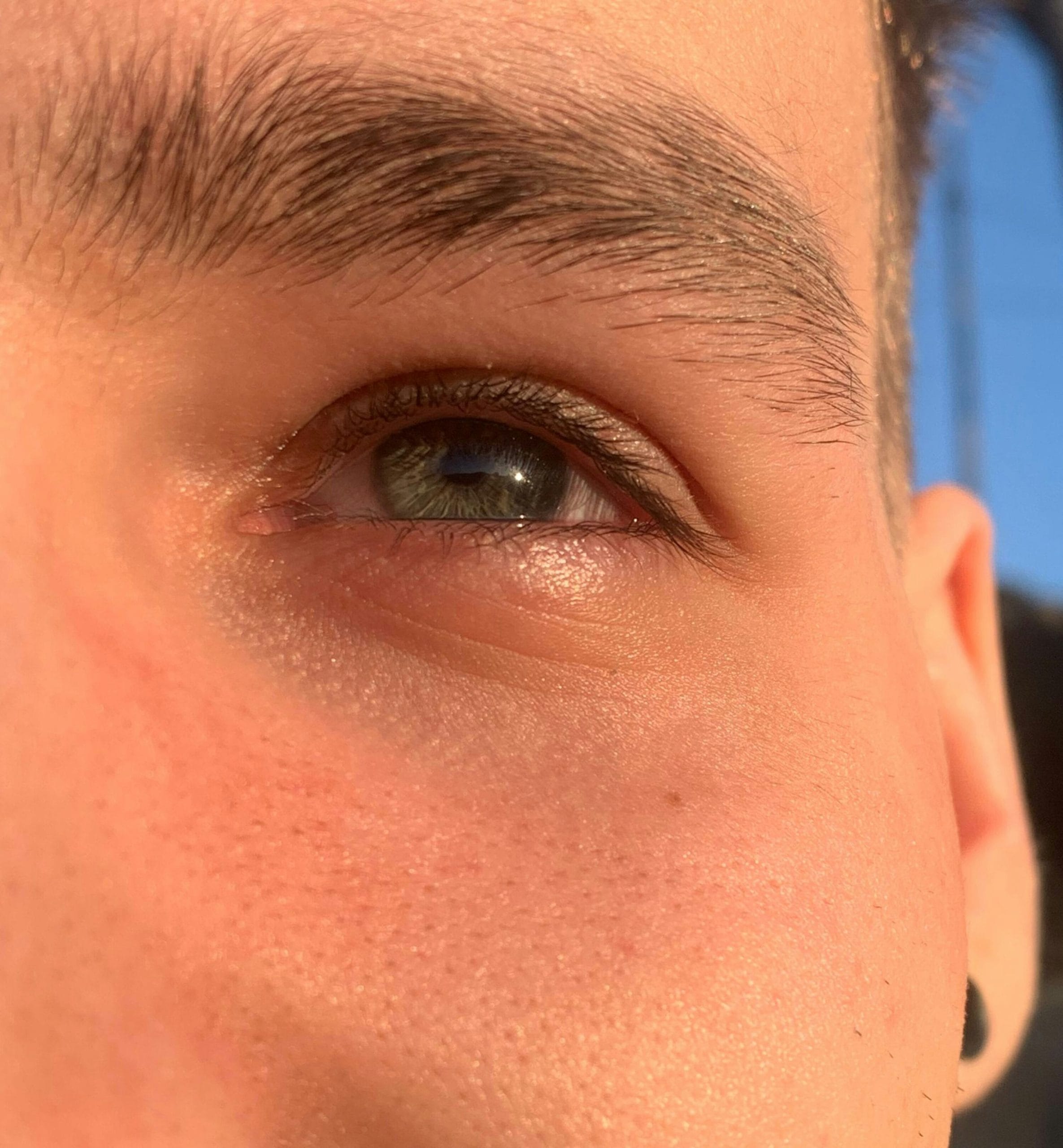 അതേസമയം വായുവിൽക്കൂടി രോഗം പകരില്ല. രോഗമുള്ളവർക്ക് വെളിച്ചത്തിലേക്കും മറ്റും നോക്കാൻ ബുദ്ധിമുട്ടാണെങ്കിൽ കണ്ണട വയ്ക്കുന്നത് ​ഗുണം ചെയ്യും. രോഗബാധിതരായ വ്യക്തികൾ, പ്രത്യേകിച്ച് സ്കൂൾ കുട്ടികളോ ഓഫീസ് ജീവനക്കാരോ ആണെങ്കിൽ, കണ്ണിലെ ചുവപ്പ് നിറം മാറുന്നതുവരെ ഒറ്റയ്ക്ക് ഒരു റൂമിൽ തുടരാൻ ശ്രമിക്കണം. മറ്റുള്ളവരുമായുള്ള സമ്പർക്കം കുറയ്ക്കുന്നതാണ് നല്ലത്. (Image Credits: Unsplash)
