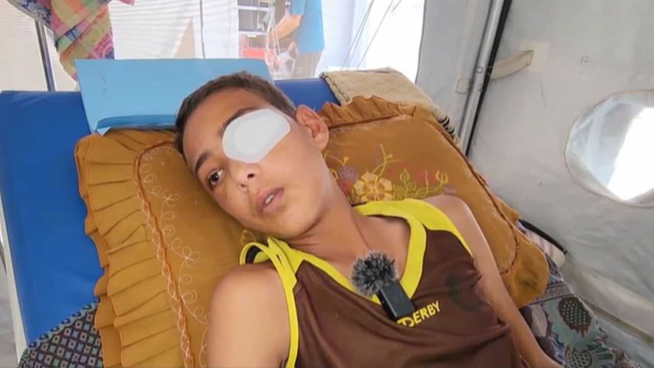 Israel-Palestine Conflict: പലസ്തീനി ബാലന്റെ കണ്ണിന് വെടിവെച്ച് ഇസ്രായേല്‍; ആക്രമണം സഹായകേന്ദ്രത്തില്‍ വെച്ച്