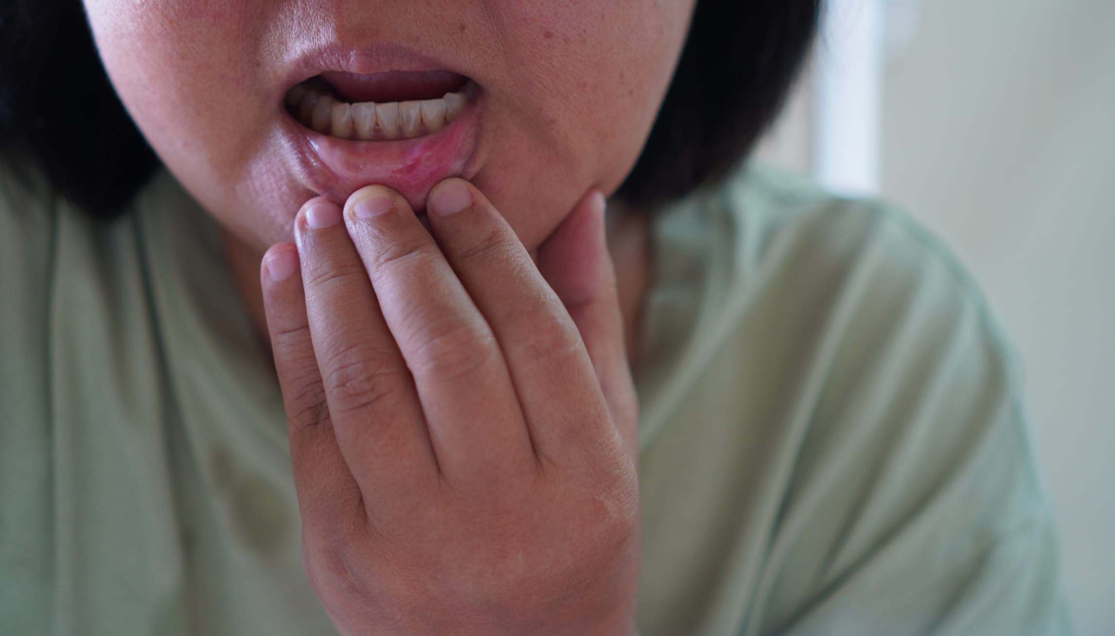 ചെറിയ കുമിളകൾ പോലെ നാവിൽ കാണപ്പെടാറുണ്ടെങ്കിൽ അത് ശ്രദ്ധിക്കണം. അവയ്ക്ക് വേദനയുണ്ടാകണമെന്നില്ല. ബാക്ടീരിയ, യീസ്റ്റ് അല്ലെങ്കിൽ വൈറസുകൾ എന്നിവ മൂലമുള്ള അണുബാധയും ഇതിന് കാരണമാണ്. ടിഎസ്എച്ച്, ഫ്രീ ടി3, റിവേഴ്സ് ടി3, ലിംഫ് മാർക്കറുകൾ എന്നിവ പോലുള്ള ചില പരിശോധനകളിലൂടെ യഥാർത്ഥ കാരണം കണ്ടെത്താൻ സാധിക്കും. (Image Credits: Gettyimages)