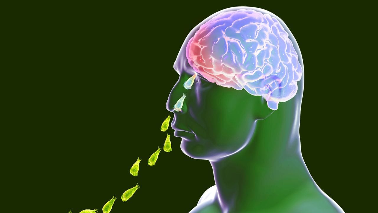 ചിലതരം അവസ്ഥകളില്‍ ശരീരത്തില്‍ ചെറിയ പാടുകളും പ്രത്യക്ഷപ്പെടാം. ശ്രദ്ധ കേന്ദ്രീകരിക്കാന്‍ ബുദ്ധമുട്ടോ, അസാധാരണമായ ക്ഷീണമോ തോന്നുകയും ചെയ്യാം. എളുപ്പത്തില്‍ പ്രകോപിതാരുകയും കാരണില്ലാതെ കരയുകയും അസ്വസ്ഥ പ്രകടിപ്പിക്കുന്നതും ലക്ഷണമാണ്. 

