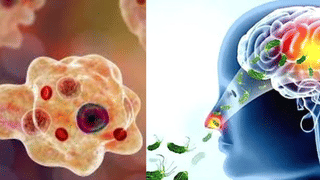 Amoebic Meningoencephalitis: അമീബിക് മസ്തിഷ്‌ക ജ്വരം; കോഴിക്കോട് ചികിത്സയിലായിരുന്നയാൾ മരിച്ചു