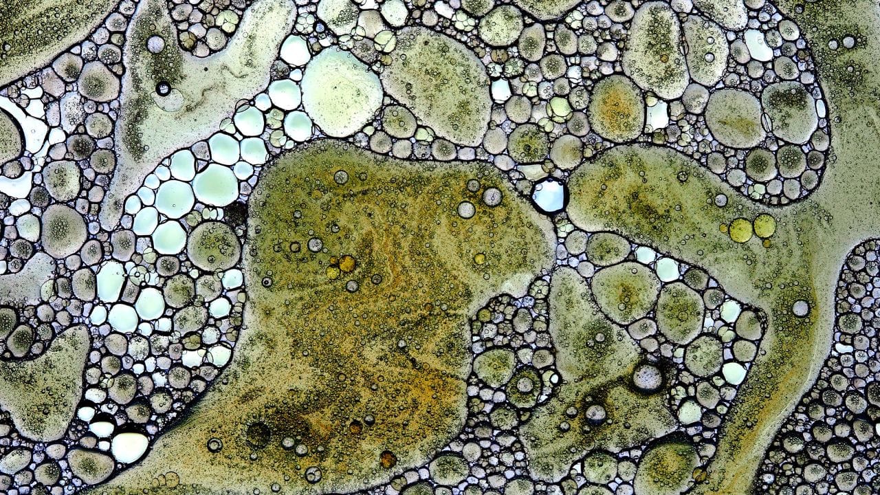 ഭക്ഷണം കഴിക്കാനോ പാല്‍ കുടിക്കാനോ മടി, എപ്പോഴും ഉറക്കം, കുട്ടികളുടെ തലയോട്ടിയില്‍ മുഴ പോലെ കാണാനാകുന്നത് എന്നിവയെല്ലാം അമീബിക് മസ്തിഷ്‌ക ജ്വരത്തിന്റെ ലക്ഷണമാണ്. 

