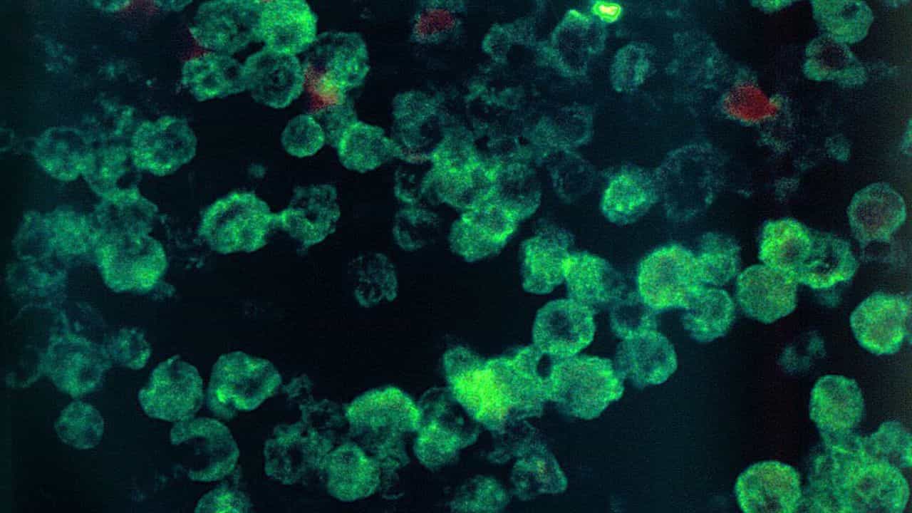 Amoebic Meningoencephalitis: സംസ്ഥാനത്ത് ഒരാൾക്കുകൂടി അമീബിക് മസ്തിഷ്‌ക ജ്വരം; രണ്ടുപേരുടെ ആരോഗ്യനില അതീവ ഗുരുതരം