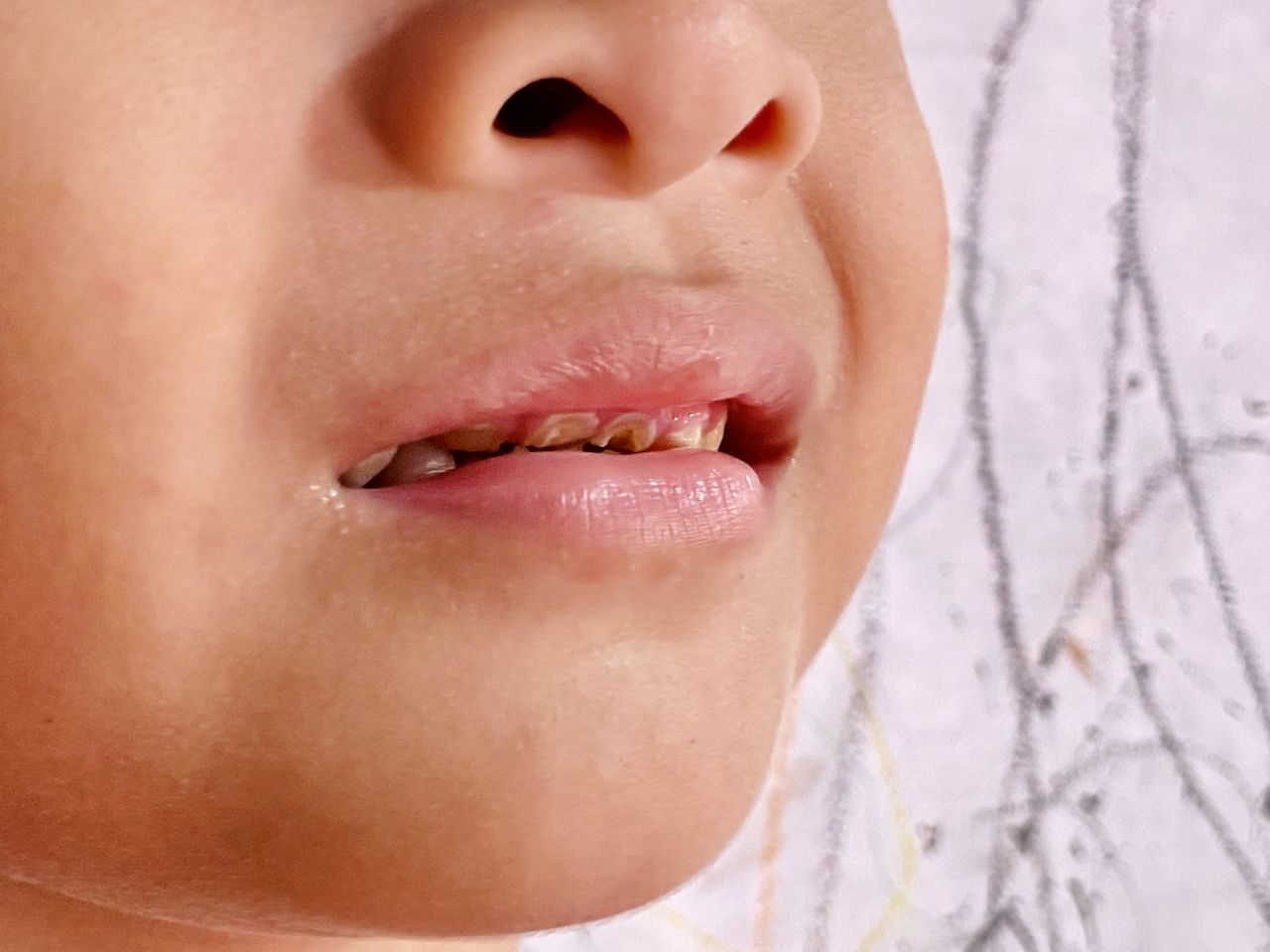 ലിപ്സ്റ്റിക് ഉപയോഗിച്ച ശേഷം നന്നായി വൃത്തിയാക്കാതിരിക്കുന്നതും ചുണ്ടിലെ കറുപ്പിന് കാരണമാകുന്നു. അതുപോലെ, ചുണ്ടുകൾ കടിക്കുന്നതും തൊലി പറിച്ചു കളയുന്നതും ഒഴിവാക്കേണ്ട പ്രധാന ശീലങ്ങളാണ്. ഇതിലൂടെയൊന്നും നിറം ലഭിക്കുന്നില്ലെങ്കിൽ, പ്രകൃതിദത്തമായ നിരവധി മാർ​ഗങ്ങൾ വേറെയുണ്ട്. നിങ്ങളുടെ ദൈനംദിന ചർമ്മസംരക്ഷണ ദിനചര്യയിൽ ഇക്കാര്യങ്ങൾ ഉൾപ്പെടുത്തുന്നത് ഏറെ ​ഗുണം ചെയ്യും.