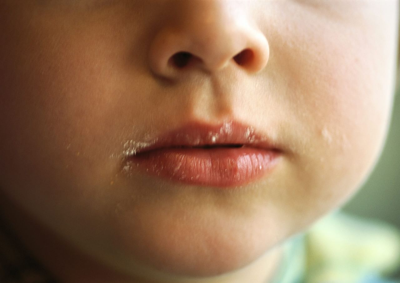 വെള്ളരിക്ക: ചർമ്മത്തിന് തിളക്കം നൽകുന്നതും ഇരുണ്ട ചുണ്ടുകൾക്ക് തിളക്കം നൽകുന്നതുമായ മറ്റൊരു ഉന്മേഷദായകമായ പ്രകൃതിദത്ത മാർ​ഗമാണ് വെള്ളരിക്ക. ഒരു വെള്ളരിക്ക നേർത്ത കഷ്ണങ്ങളാക്കി മുറിച്ച് ചുണ്ടുകളിൽ കുറച്ച് മിനിറ്റ് സൗമ്യമായി മസാജ് ചെയ്യുക. കുക്കുമ്പർ മിക്സ് ചെയ്യുകയോ ഗ്രേറ്റ് ചെയ്യുകയോ ചെയ്ത് നീര് എടുക്കുക. 15 മിനിറ്റ് നേരം ചുണ്ടിൽ പുരട്ടിയ ശേഷം ചുണ്ടുകൾ കഴുകുക. നിങ്ങളുടെ ചുണ്ടുകൾ ഉണങ്ങിയ ശേഷം ഒരു ലിപ് ബാം പുരട്ടുക. (Image Credits: Gettyimages)