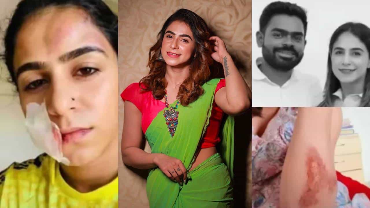 Jaseela Parveen: അയാൾ എന്റെ വയറ്റിൽ രണ്ടുതവണ ചവിട്ടി, വീണുവെന്ന് കള്ളം പറഞ്ഞ് ആശുപത്രിയിൽ എത്തിച്ചു; കാമുകന്റെ ക്രൂരമർദ്ദനത്തിന് ഇരയായി നടി ജസീല!
